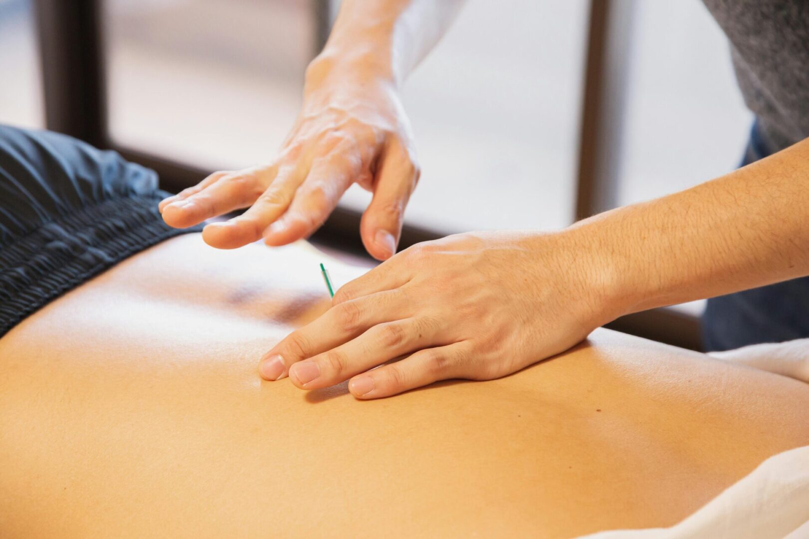 benefits of acupuncture
